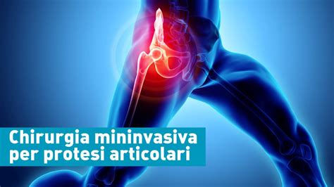 Gelatina per protesi articolari: Un'opzione incredibilmente versatile e biocompatibile!